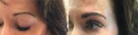 55-64 year old woman treated with Microblading
